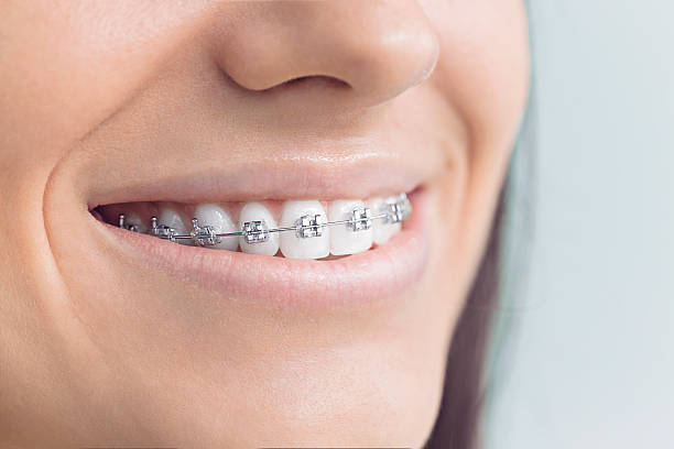 Best Dental Fillings (Composite and Amalgam)  in Molalla, OR